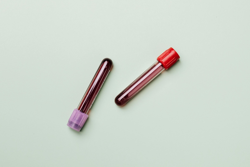 Vital Blood Markers for Metabolic Health: Cholesterol, Vitamin D, HbA1c & More